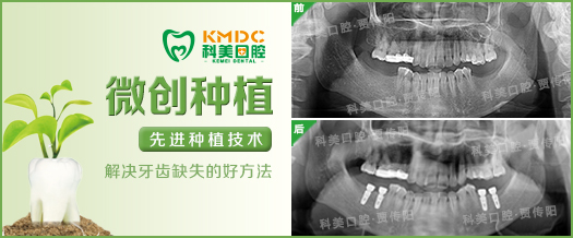 长春传阳种植牙 解决缺牙烦恼