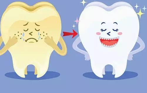 定期洗牙 保持干净的口腔环境