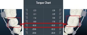 数字化正畸 预见你的美